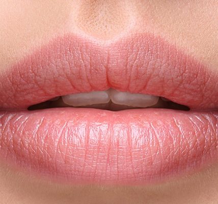 Zabieg powiększania ust odbywa się najczęściej poprzez zastosowanie zastrzyków z kwasem hialuronowym. Źródło: drjohnburroughs.com.