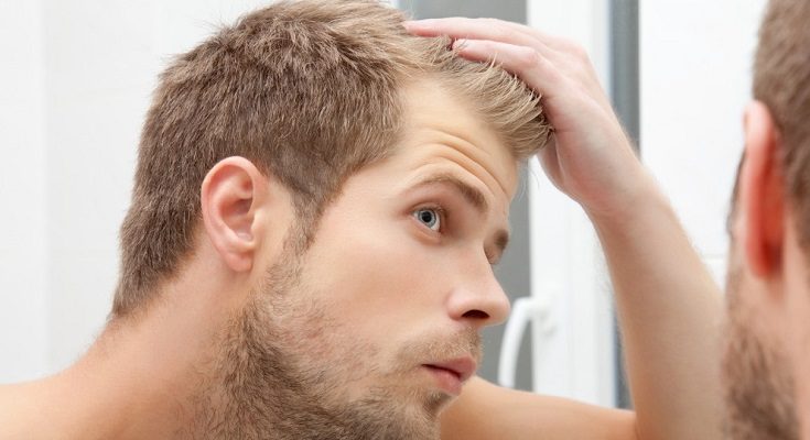 Wypadanie włosów - jak walczyć z łysieniem? Fotografia: uk.askmen.com.