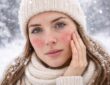 jak dbać o naszą skórę w okresie zimowym